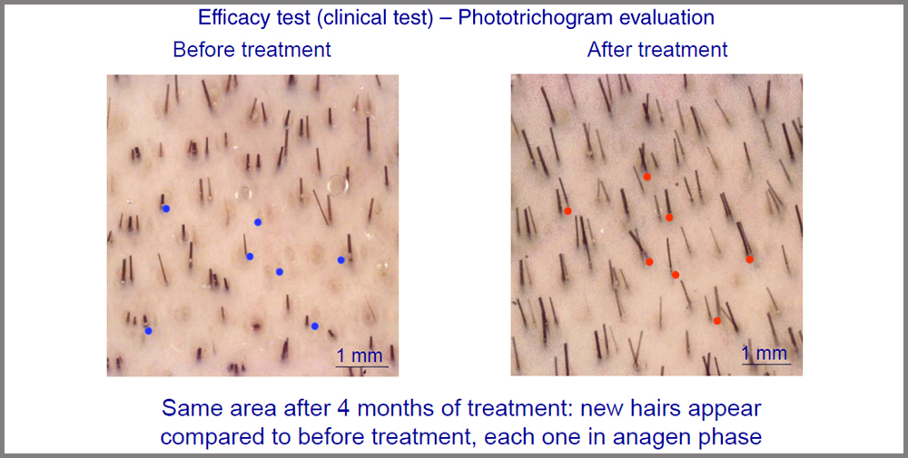 trichogram evaluation quantification.jpg