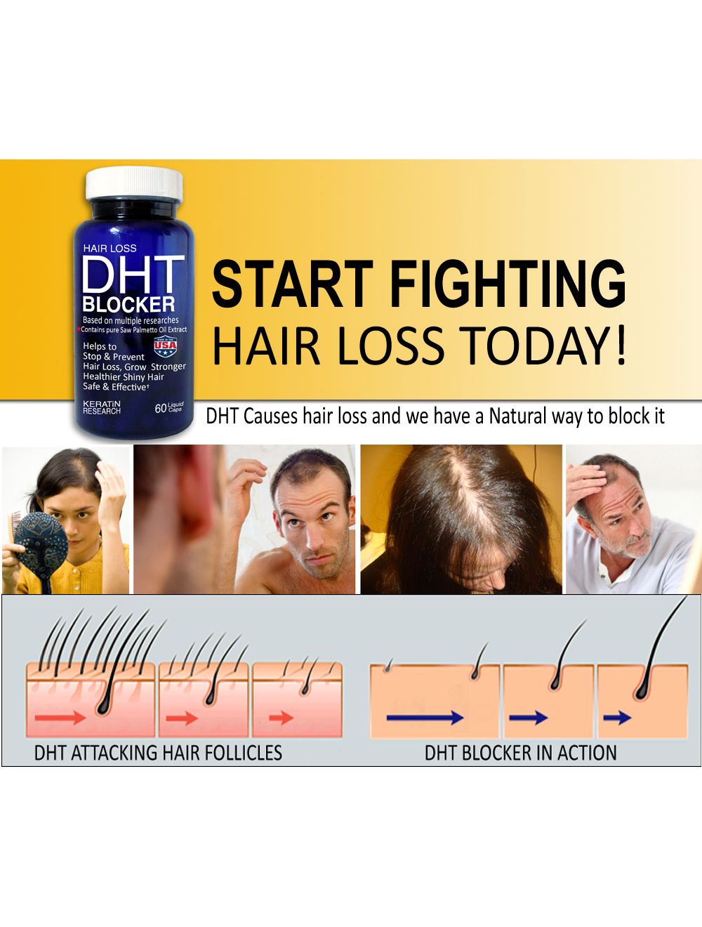 Stop hair loss natural supplements